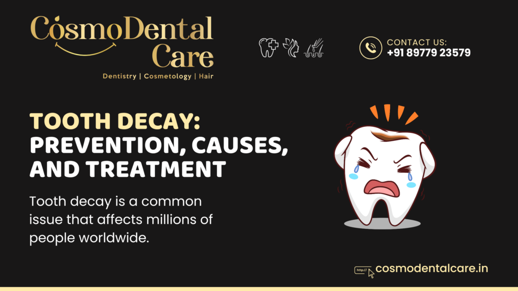 tooth decay